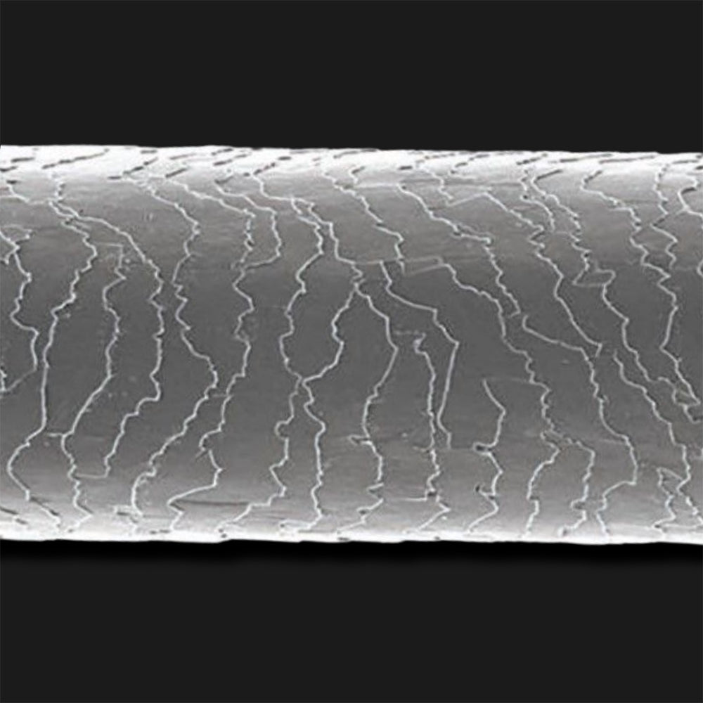 image comparison after