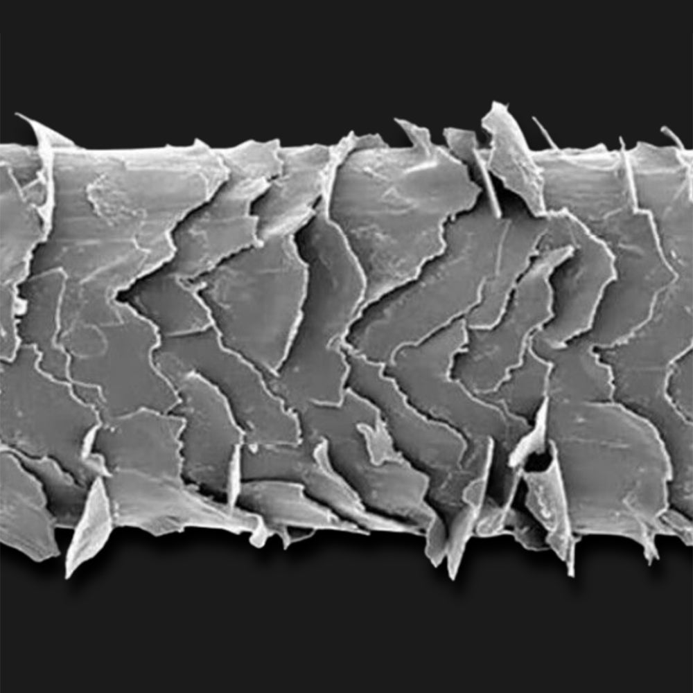 image comparison before